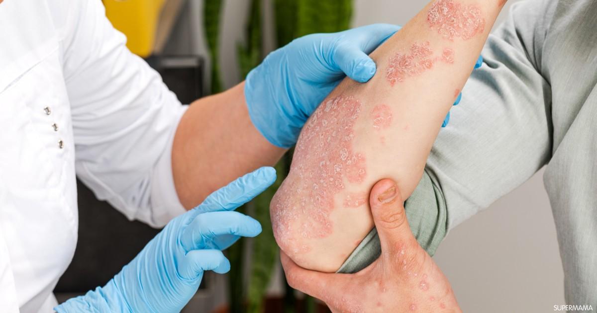 علاج الأمراض المزمنة